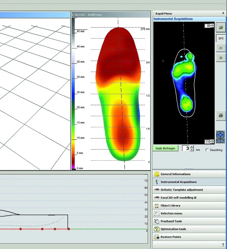 Insole Design using CAD Software